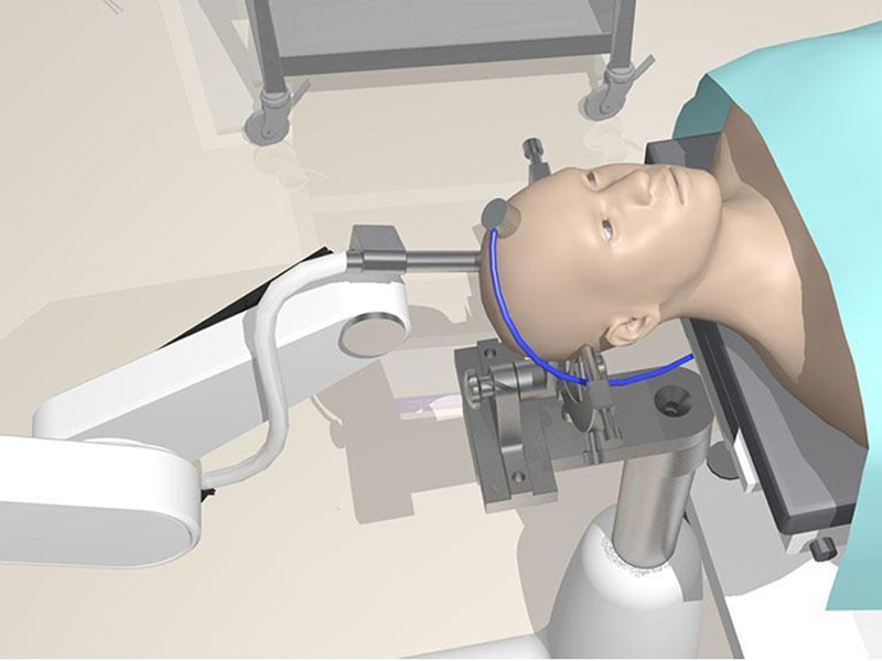 機器人腦外科手術提供精確動力
